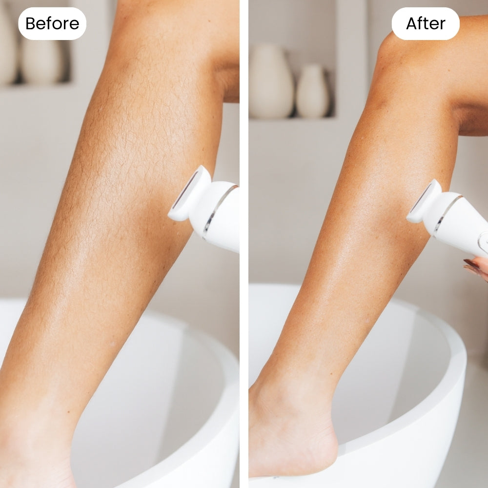 LadyShave Pro 7-in-1